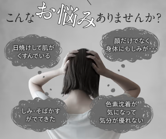 ホワイトルマン最安値