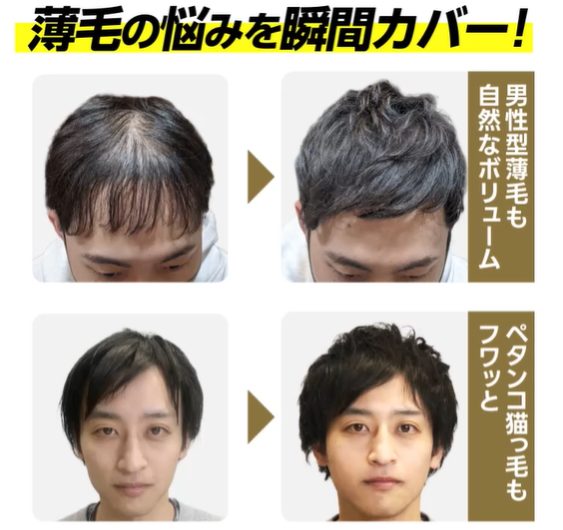 CAX(カックス) 最安値販売店!ドラッグストア、薬局でも売ってるの?【フサ髪決まる!男に自信!】