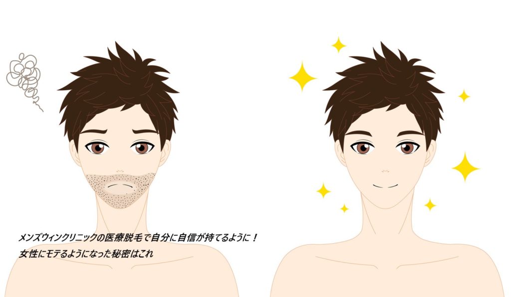 メンズウィンクリニックの医療脱毛が選ばれる理由は?実際に利用している男性の口コミ、評判も紹介【最新機器でコスパ/タイパ最高】
