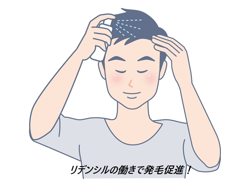 モウダスはドンキ、薬局でも売ってるのか調査!最安値の販売店を紹介【日本で唯一*の薬用発毛促進剤】