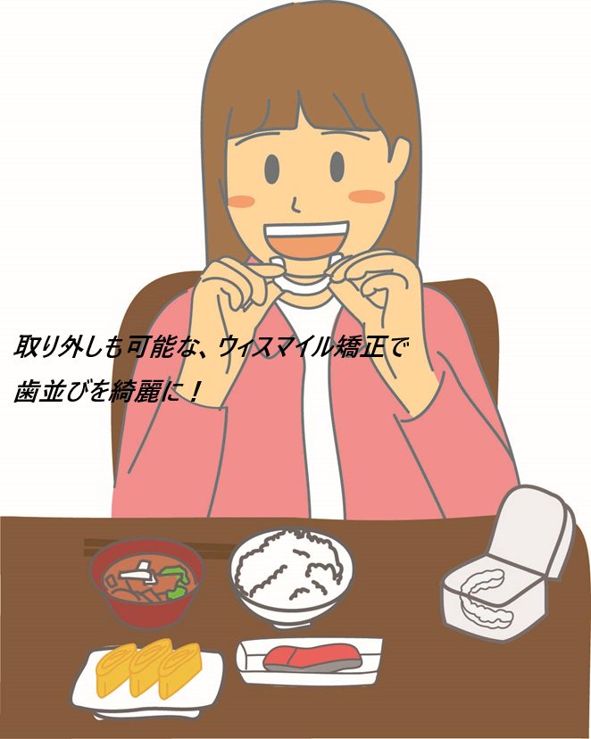 ウィスマイル矯正の口コミ、評判で歯並びを変えたい人の本音をチェック【第一印象が全然違う!次世代マウスピースでサクっと時短矯正】