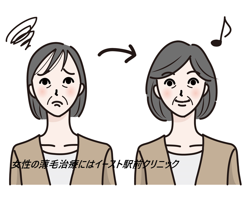 イースト駅前クリニックの女性の薄毛治療の口コミ、評判で本音をチェック!【オンライン診療は電話1本で解決!女性の薄毛治療】